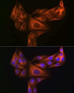 alpha Tubulin 4a Rabbit anti-Human, Mouse, Rat, Clone: 1K6U1, Novus Biologicals 100 &mu;g | Buy Online | Novus Biologicals | Fisher Scientific