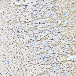 alpha Tubulin 4a Rabbit anti-Human, Mouse, Rat, Clone: 1K6U1, Novus Biologicals 100 &mu;g | Buy Online | Novus Biologicals | Fisher Scientific