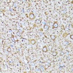 alpha Tubulin 4a Rabbit anti-Human, Mouse, Rat, Clone: 1K6U1, Novus Biologicals 100 &mu;g | Buy Online | Novus Biologicals | Fisher Scientific