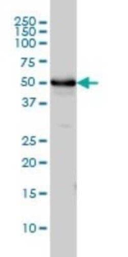 alpha Tubulin 4a Antibody (2E11), Novus Biologicals 0.1 mg | Buy Online | Novus Biologicals | Fisher Scientific