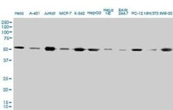 alpha Tubulin 4a Antibody (2E11), Novus Biologicals 0.1 mg | Buy Online | Novus Biologicals | Fisher Scientific