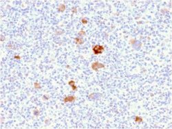 bcl-x Antibody (BCL2L1/2406) - Azide and BSA Free, Novus Biologicals 100