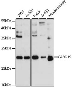 bcl10-interacting CARD protein Antibody - Azide and BSA Free, Novus Biologicals
