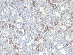 CD57 Antibody (SPM129), Novus Biologicals 0.1mg; Unlabeled:Antibodies,