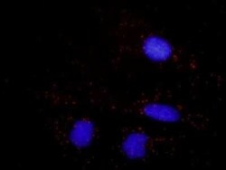 beta 2-Microglobulin Antibody (3F9-2C2), Novus Biologicals 0.1 mg | Buy Online | Novus Biologicals | Fisher Scientific