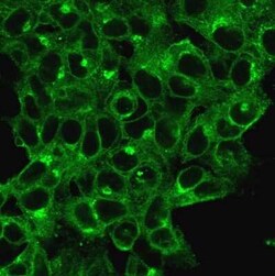 beta 2-Microglobulin Antibody (B2M/1118) - Azide and BSA Free, Novus Biologicals
