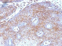 beta 2-Microglobulin Antibody (B2M/1118), Novus Biologicals:Antibodies:Primary