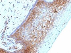 beta 2-Microglobulin Antibody (B2M/1118), Novus Biologicals:Antibodies:Primary