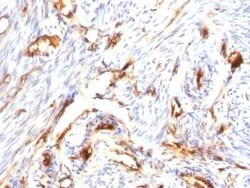 beta 2-Microglobulin Antibody (B2M/1118), Novus Biologicals:Antibodies:Primary