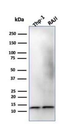 beta 2-Microglobulin Antibody (B2M/1118), Novus Biologicals:Antibodies:Primary