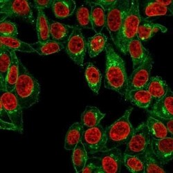 beta 2-Microglobulin Antibody (B2M/961) - Azide and BSA Free, Novus Biologicals:Antibodies:Primary