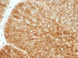 beta 2-Microglobulin Antibody (B2M/961) - Azide and BSA Free, Novus Biologicals:Antibodies:Primary