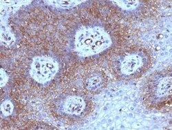 beta 2-Microglobulin Antibody (B2M/961) - Azide and BSA Free, Novus Biologicals:Antibodies:Primary
