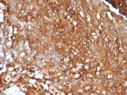 beta 2-Microglobulin Antibody (B2M/961) - Azide and BSA Free, Novus Biologicals:Antibodies:Primary