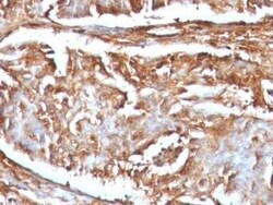 beta 2-Microglobulin Antibody (B2M/961) - Azide and BSA Free, Novus Biologicals:Antibodies:Primary