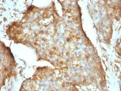 beta 2-Microglobulin Antibody (B2M/961) - Azide and BSA Free, Novus Biologicals:Antibodies:Primary
