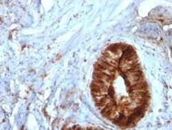 beta 2-Microglobulin Antibody (B2M/961) - Azide and BSA Free, Novus Biologicals:Antibodies:Primary
