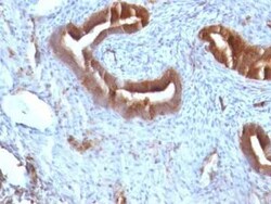 beta 2-Microglobulin Antibody (B2M/961) - Azide and BSA Free, Novus Biologicals:Antibodies:Primary