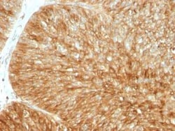 beta 2-Microglobulin Antibody (B2M/961), Novus Biologicals 0.1mg; Unlabeled:Antibodies,