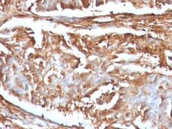 beta 2-Microglobulin Antibody (B2M/961), Novus Biologicals 0.1mg; Unlabeled:Antibodies,