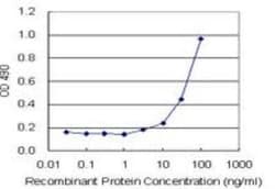 beta 2-Microglobulin Antibody Pair, Novus Biologicals™