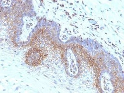 beta 2-Microglobulin Antibody (SPM617) - Azide and BSA Free, Novus Biologicals