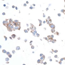 beta-Actin Antibody (BLR057F), Novus Biologicals 100 &mu;L; Unconjugated:Antibodies,