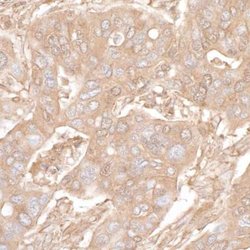 beta-Actin Antibody (BLR057F), Novus Biologicals 100 &mu;L; Unconjugated:Antibodies,