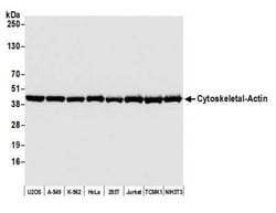 beta-Actin Antibody (BLR057F), Novus Biologicals™