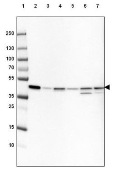 beta-Actin Antibody (CL3868), Novus Biologicals 25 &mu;L; Unconjugated:Antikörper