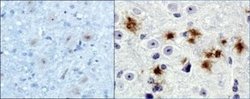 beta Amyloid Antibody (MOAB-2) - Azide and BSA Free, Novus Biologicals