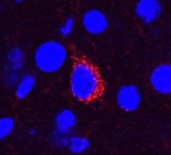 beta Amyloid Antibody (MOAB-2) - Azide and BSA Free, Novus Biologicals