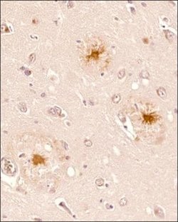 beta Amyloid Antibody (MOAB-2) - Azide and BSA Free, Novus Biologicals