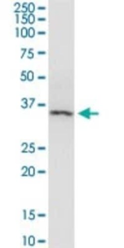 beta-Arrestin 2 Antibody (4D2), Novus Biologicals 0.1 mg | Buy Online | Novus Biologicals | Fisher Scientific