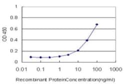 beta B1 Crystallin Antibody (3D9), Novus Biologicals 0.1 mg; Unconjugated:Antibodies,
