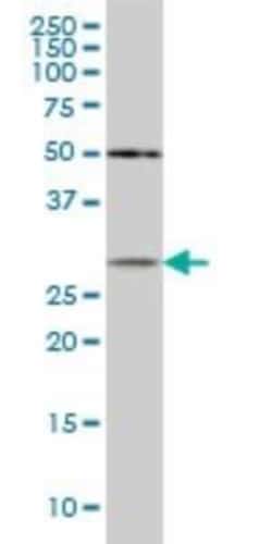 beta B1 Crystallin Antibody (3D9), Novus Biologicals 0.1 mg; Unconjugated:Antibodies,