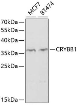 beta B1 Crystallin Antibody - BSA Free, Novus Biologicals 0.1 mL, Unconjugated:Antibodies,
