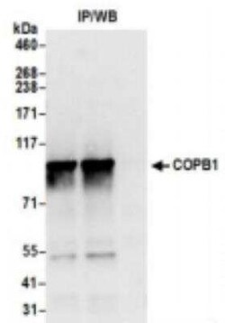 beta COP Antibody, Novus Biologicals 100 &mu;g; Unconjugated:Antibodies,