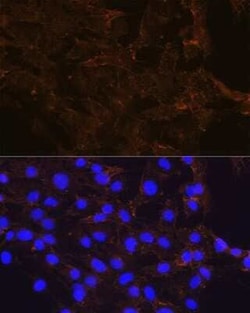 beta-Catenin Rabbit anti-Human, Mouse, Rat, Clone: 9L6X0, Novus Biologicals 100 &mu;g | Buy Online | Novus Biologicals | Fisher Scientific