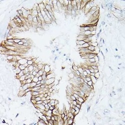 beta-Catenin Rabbit anti-Human, Mouse, Rat, Clone: 9L6X0, Novus Biologicals 100 &mu;g | Buy Online | Novus Biologicals | Fisher Scientific