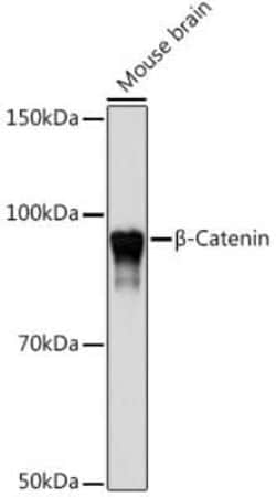 beta-Catenin Rabbit anti-Human, Mouse, Rat, Clone: 9L6X0, Novus Biologicals 100 &mu;g | Buy Online | Novus Biologicals | Fisher Scientific
