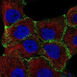 beta-Catenin Antibody (CL3689), Novus Biologicals:Antibodies:Primary Antibodies