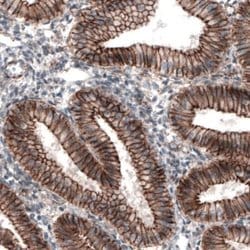 beta-Catenin Antibody (CL3689), Novus Biologicals:Antibodies:Primary Antibodies
