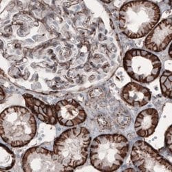 beta-Catenin Antibody (CL3689), Novus Biologicals:Antibodies:Primary Antibodies