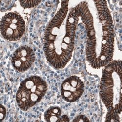 beta-Catenin Antibody (CL3689), Novus Biologicals:Antibodies:Primary Antibodies