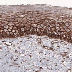 beta-Catenin Antibody (CL3689), Novus Biologicals:Antibodies:Primary Antibodies