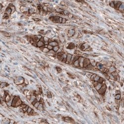 beta-Catenin Antibody (CL3689), Novus Biologicals:Antibodies:Primary Antibodies