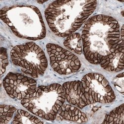 beta-Catenin Antibody (CL3689), Novus Biologicals:Antibodies:Primary Antibodies