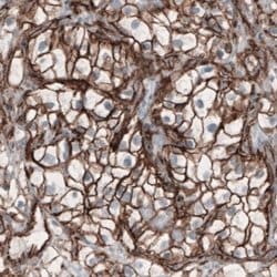 beta-Catenin Antibody (CL3689), Novus Biologicals:Antibodies:Primary Antibodies