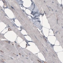 beta-Catenin Antibody (CL3689), Novus Biologicals:Antibodies:Primary Antibodies